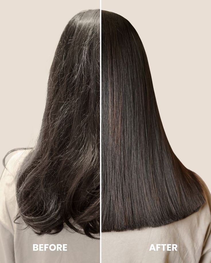 Biotin Therapy